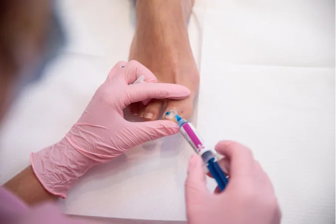 Nagelbeugel met composiet